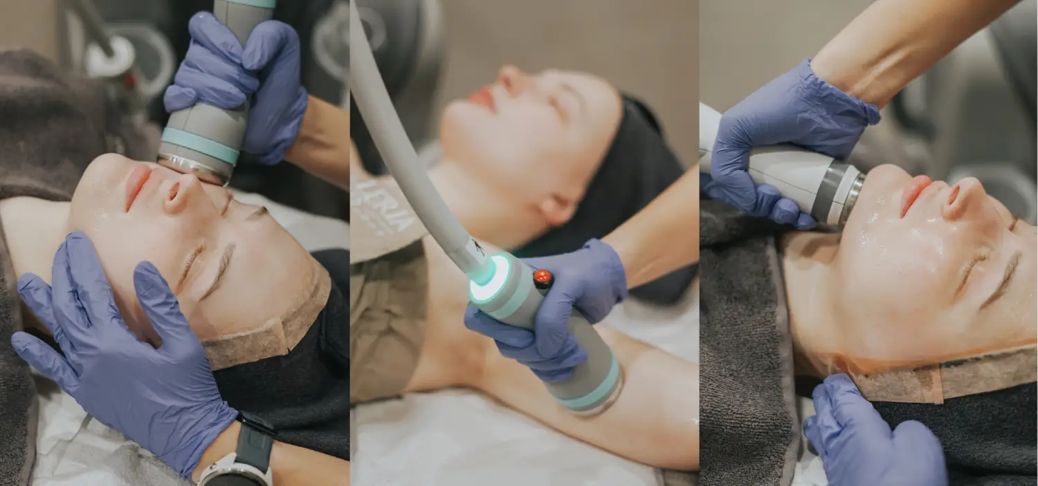 Mengapa Perawatan Laser Dermatologi Menjadi Pilihan