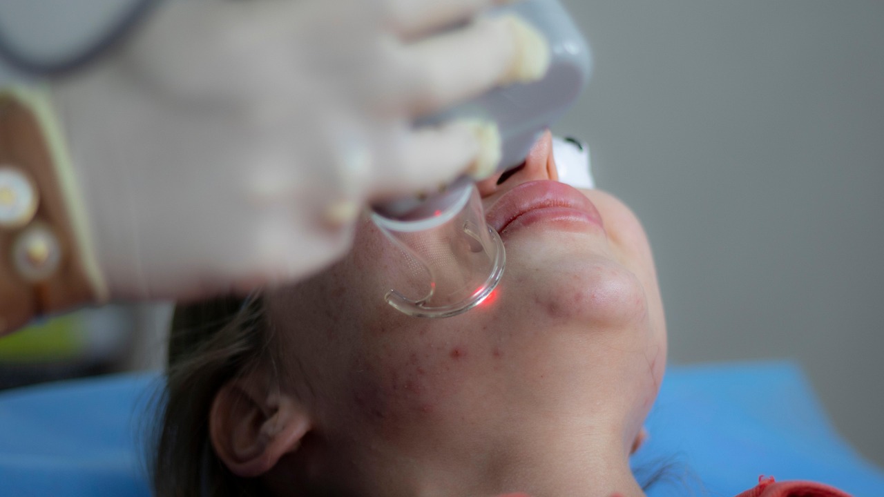 Perawatan Laser Dermatologi